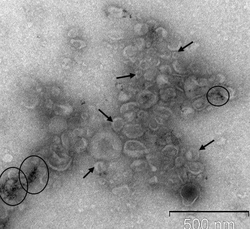 ПЭМ-изображение экзосом молока 3